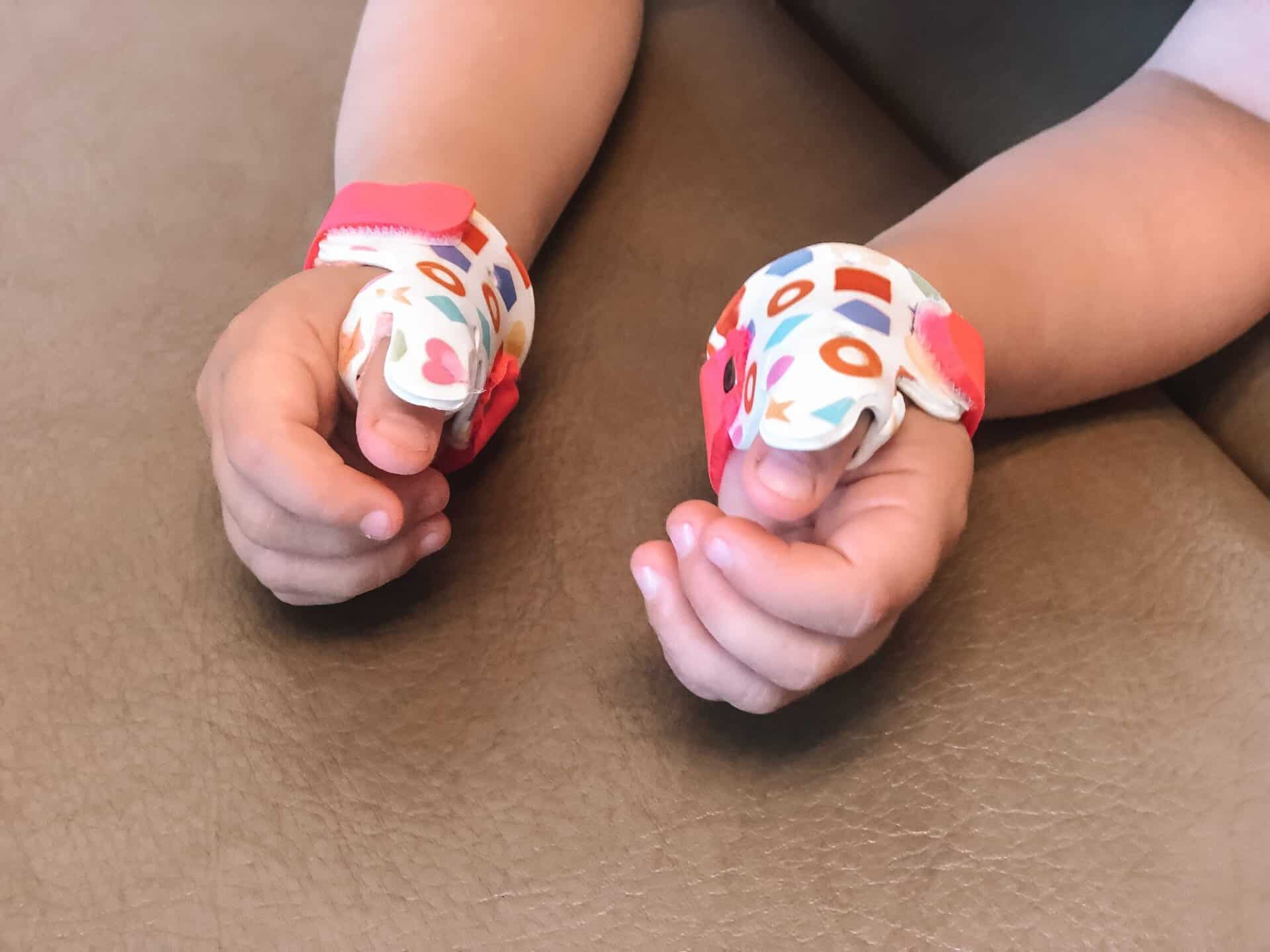 Pediatric Thumb Splints