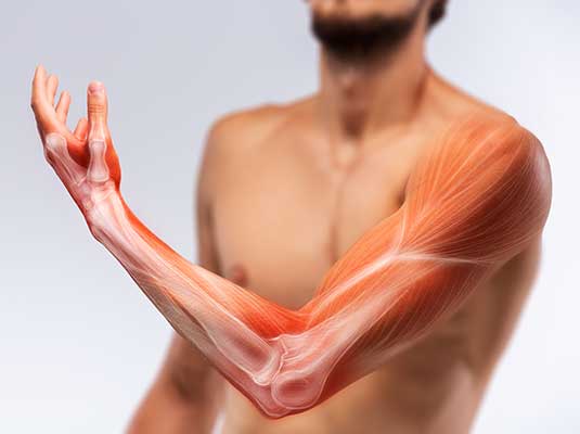 Lymphedema Management